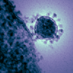 Example of a coronavirus