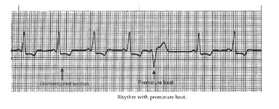 Underlying rhythm