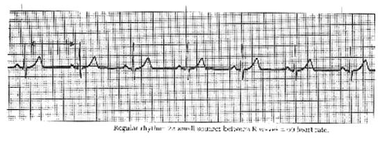 Calculate regular hear rate